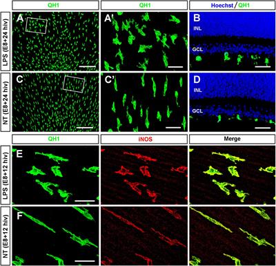 LPS-stimulated microglial cells promote ganglion cell death in organotypic cultures of quail embryo retina